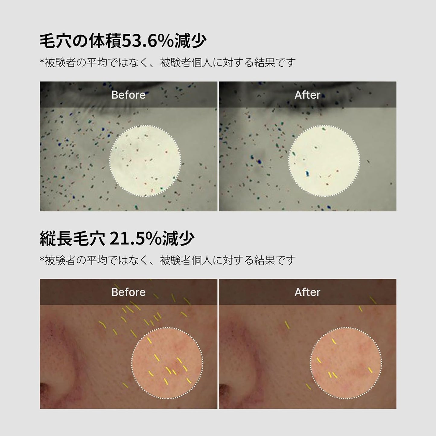 MediCube Zero Pore One Day Cream, 1.7 fl oz (50 ml), Medicube Zero Pore One Day Cream, 1.7 fl oz (50 ml)