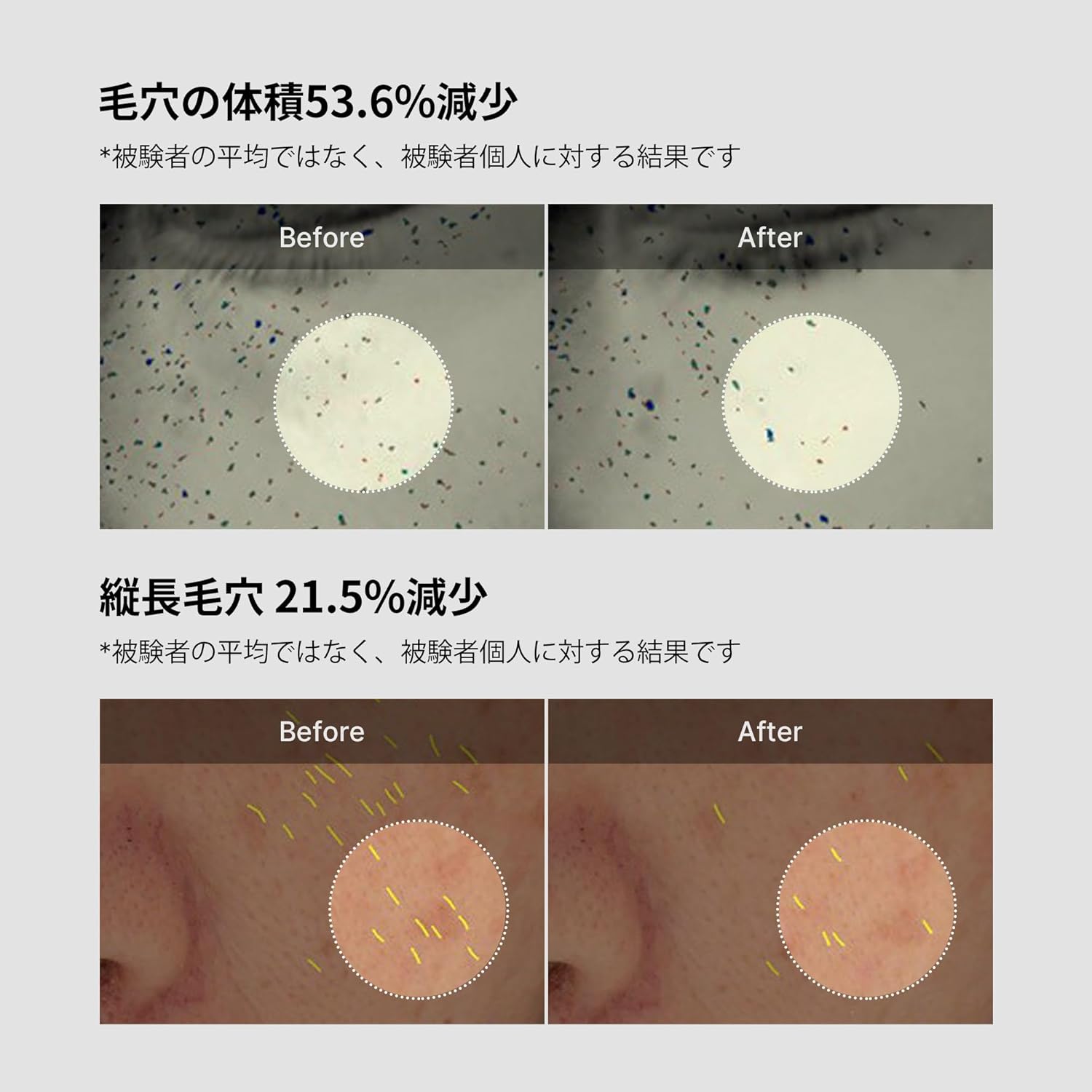 MediCube Zero Pore One Day Cream, 1.7 fl oz (50 ml), Medicube Zero Pore One Day Cream, 1.7 fl oz (50 ml)