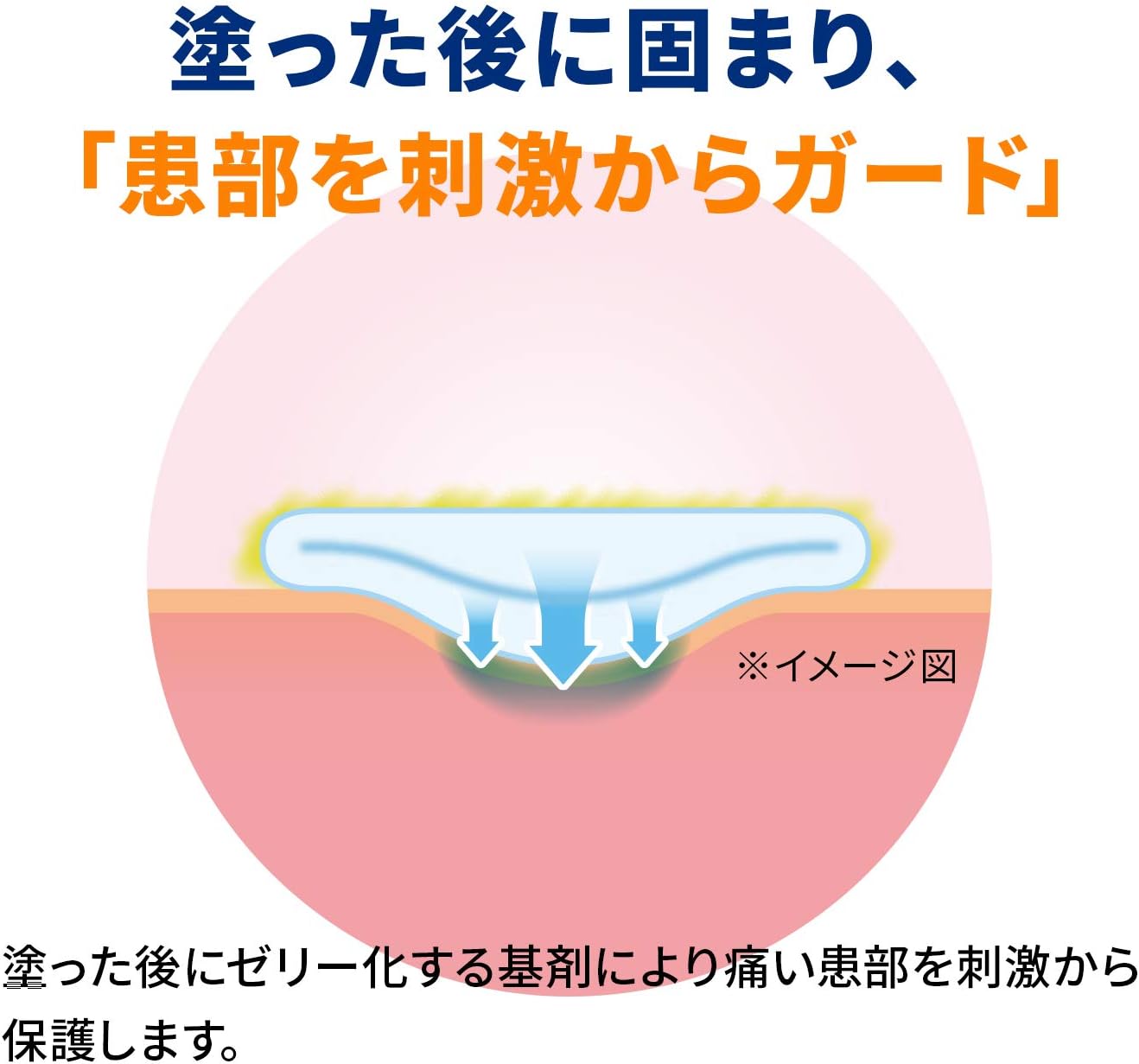 【指定第2類医薬品】アフタガード 5g