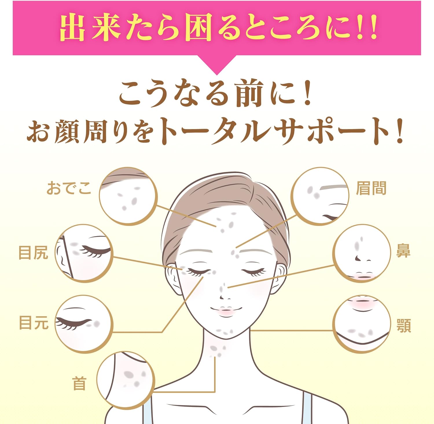 [Official] Keshimin Penetrating Lotion, Moist & Moist and Moist Refill, Formulated with Vitamin C Derivatives and V White C, For Prevention of Freckles, Keshimin [Kobayashi Pharmaceutical] Quasi-Drug
