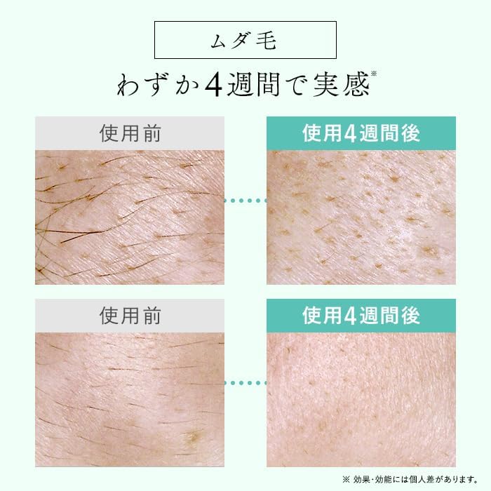 【Official Store】 Stella Beaute IPL & LED Light Beauty Device (Monsanto Gray)
