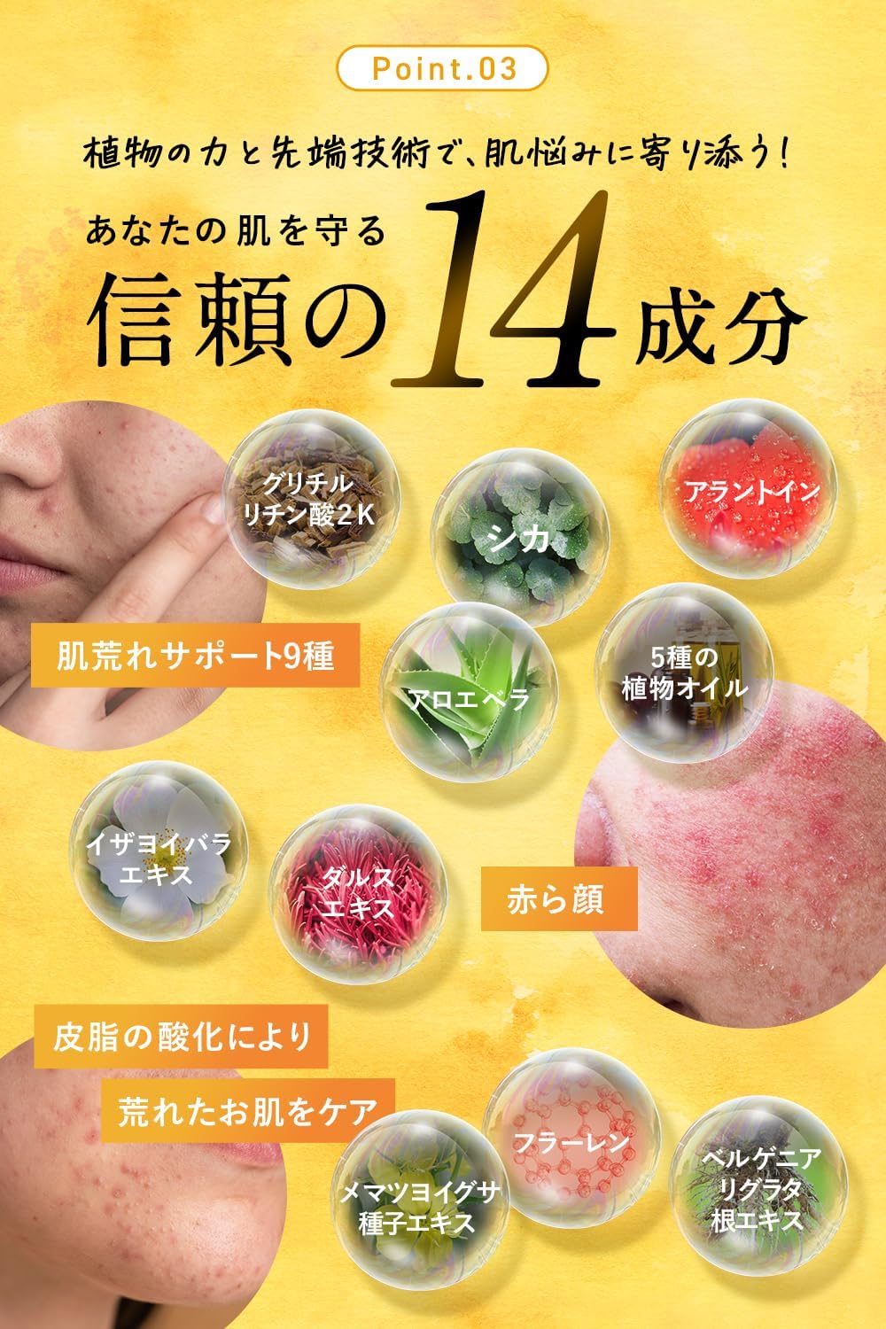 Azelaic Acid 20% Niacinamide Face Oil, 0.9 oz (25 g)