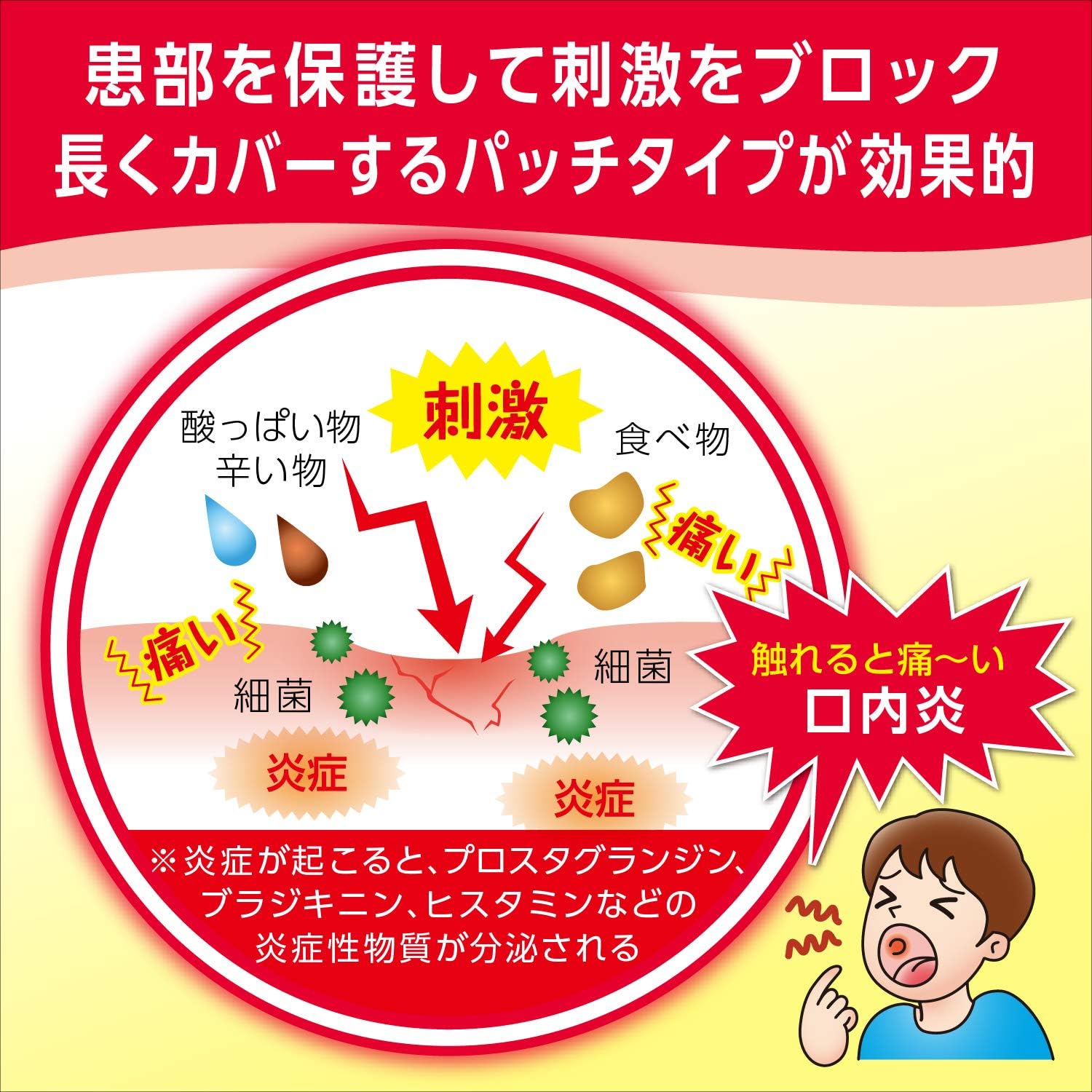 【指定第2類医薬品】口内炎パッチ大正クイックケア 10枚