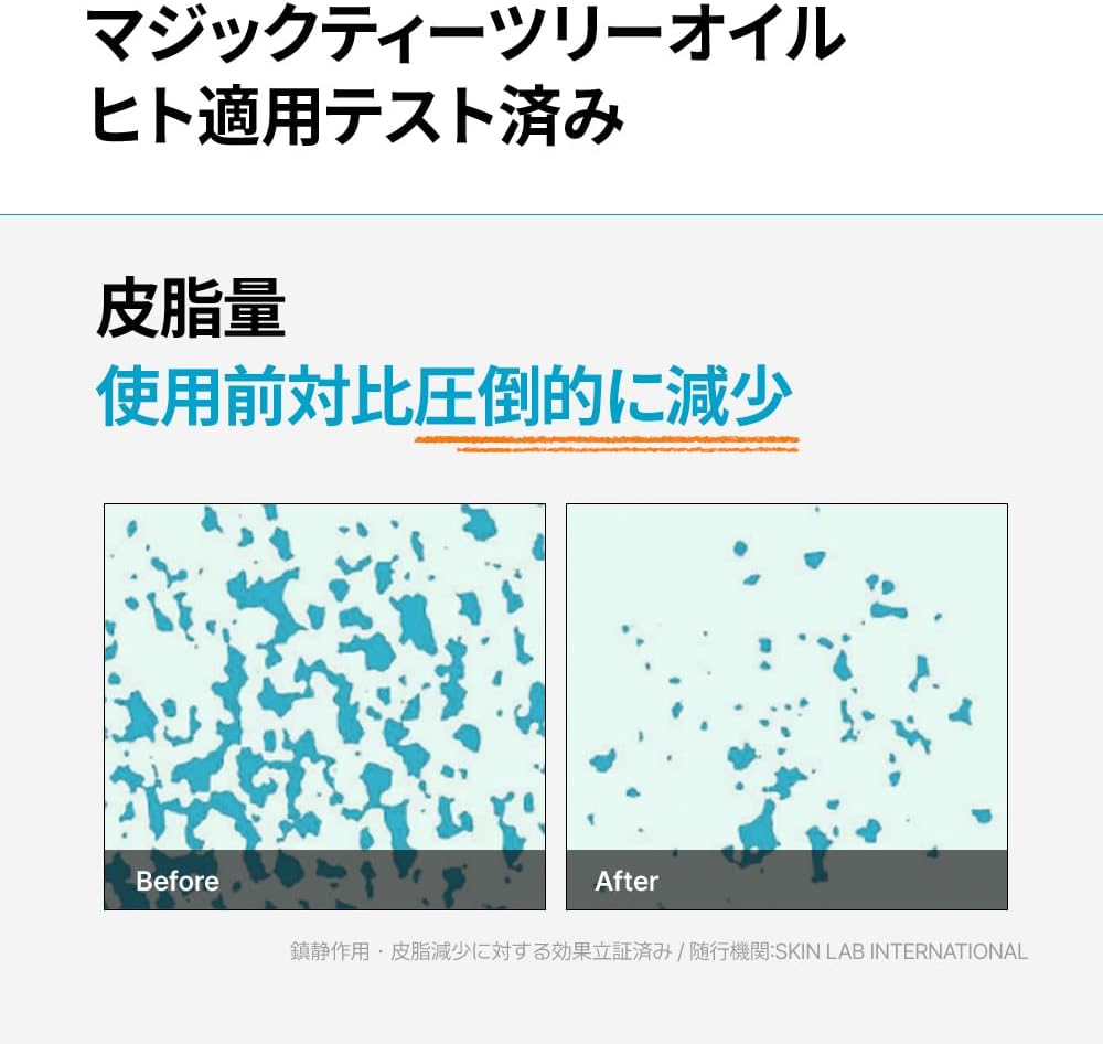 BLANC Official Magic Tea Tree Oil, 0.7 fl oz (20 ml), Skin Trouble, Serum, Sensitive Skin, Mask, Korean Cosmetics, Pigmentation, Face Oil, Unisex Body, Skin Care