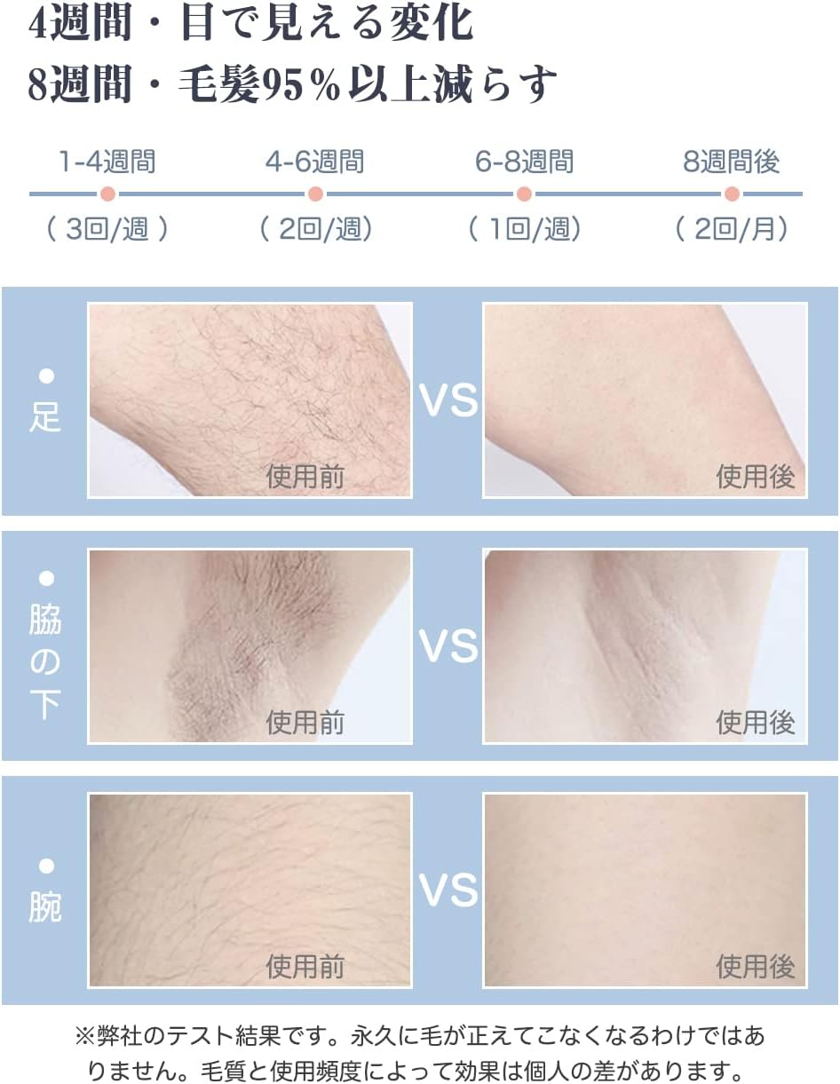 Epilator (2023 Salon Grade Light Epilator), 990,000 Rounds for Hair Removal, Cold Sensation Epilator, Women's, Men's, Beard, Face, Beard, Arms, Arms, Full Body, 5 Level Adjustment, Manual/Automatic