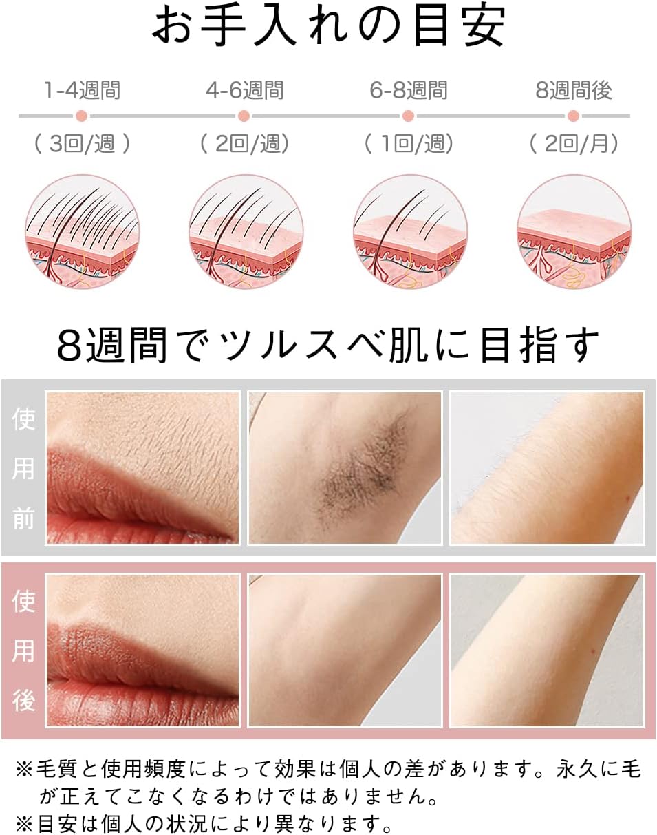 Epilator, 990,000 Rounds Hair Removal, Cold Sensation Function, Light Epilator, Continuous Flash, 5 Level Adjustment, Manual/Automatic Do, Waste Hair Treatment, Face, Armpits, Beard, VIO, Women's,