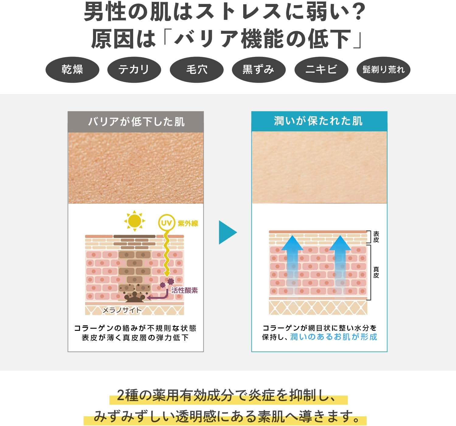 Men's All-in-One Gel 7.1 oz (200 g) (Tube) (Can be Used for Whole Body Lotion, Milky Lotion, Beauty Essence, Stains Freckles, UV Care)