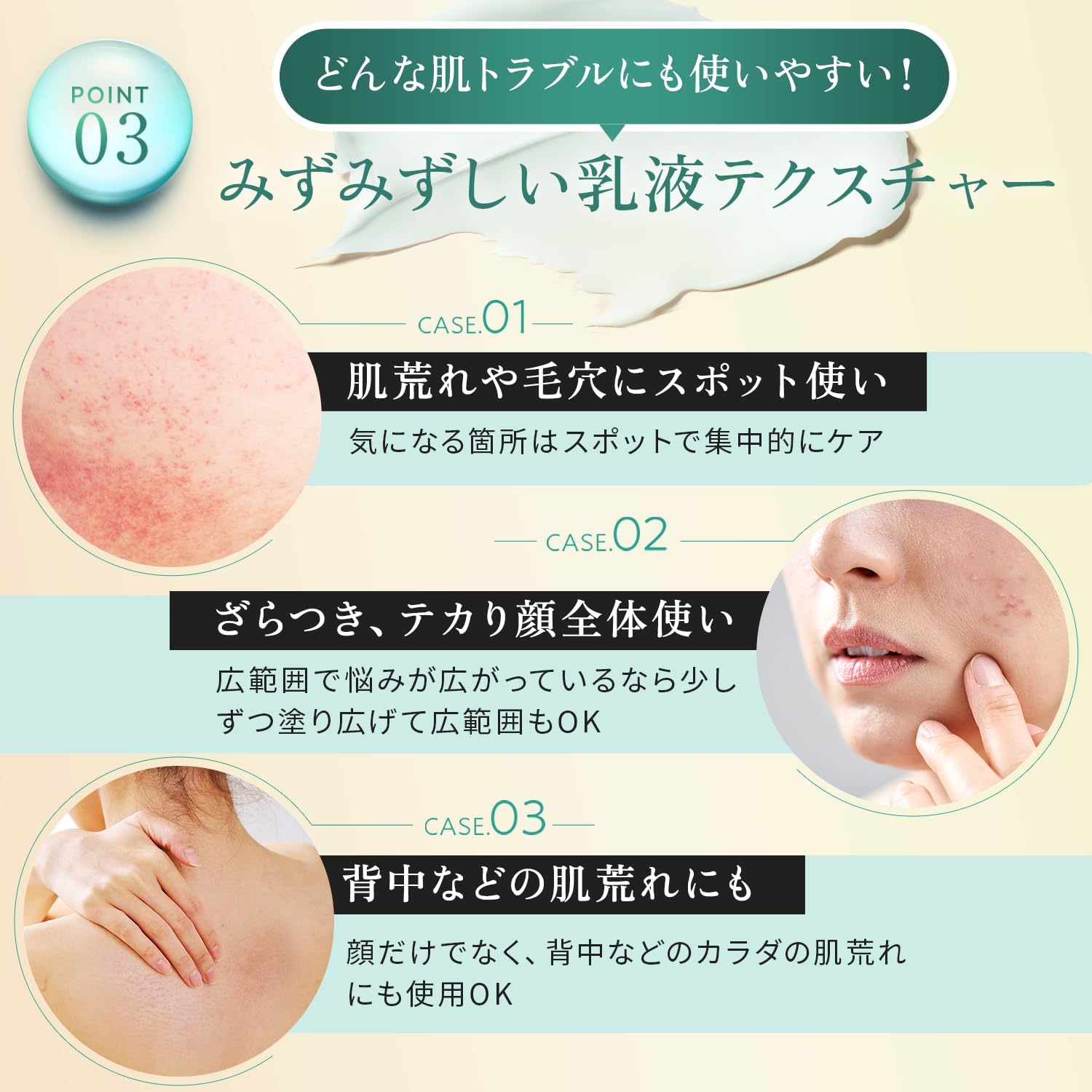 SISI Smart Activator, 1.1 oz (30 g), Azelaic Acid, Cream, Deer, CICA, Sebum Suppression, Pores, Made in Japan