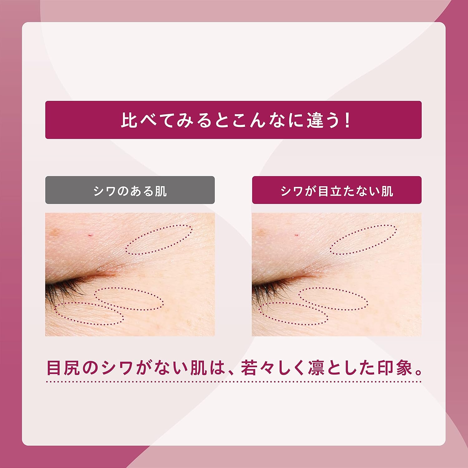 【医薬部外品】 ONE BY KOSE(ワンバイコーセー) ディープ ハイドレーター (つめかえ用) 150mL 化粧水 高保湿 エイジングケア シワ改善 美白