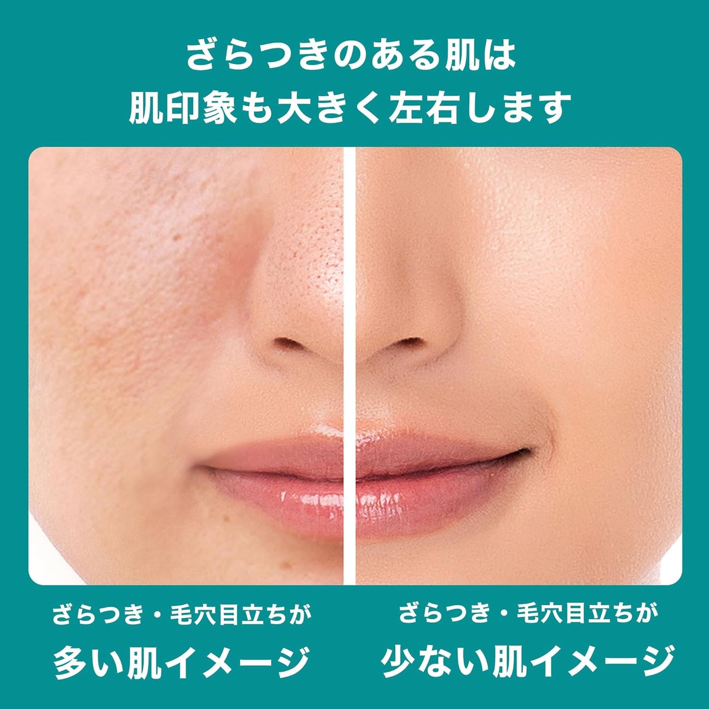 La Roche-Posay Serum Efacura Peel Care Serum, Sensitive Skin, Salicylic Acid, Mixed Skin, Pores, Green Peel Care, 1.1 fl oz (30 ml)