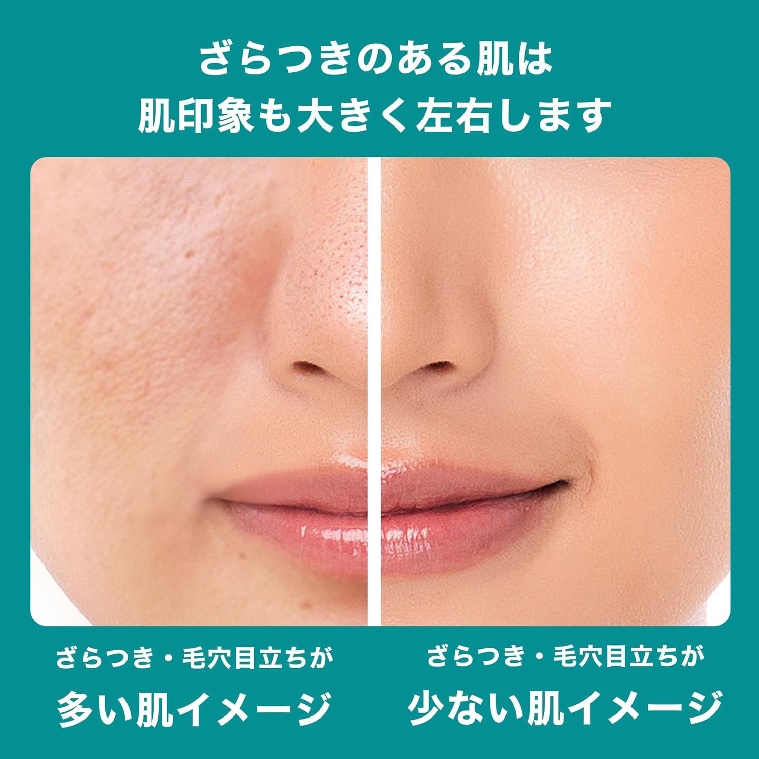 La Roche-Posay Serum Efacura Peel Care Serum, Sensitive Skin, Salicylic Acid, Mixed Skin, Pores, Green Peel Care, 1.1 fl oz (30 ml)