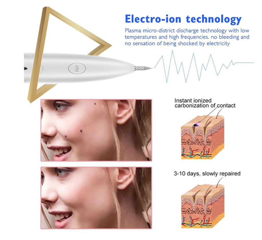 サロンプラズマペン,黒点掃除機,レーザー,そばかす,皮膚,ほくろ,顔,いぼ,タトゥー除去剤